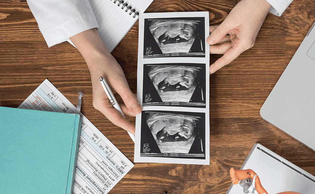 pregnancy-planning